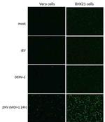 Zika Virus NS1 (strain H/PF/2013) Polyclonal Antibody