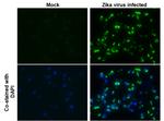 Zika Virus NS2B (strain H/PF/2013) Polyclonal Antibody