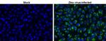 Zika Virus NS2B (strain H/PF/2013) Polyclonal Antibody
