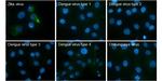 Zika Virus prM (strain H/PF/2013) Polyclonal Antibody