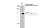 Chikungunya Virus NSP3 Antibody in Western Blot (WB)