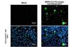 MERS Coronavirus Envelope Protein Antibody in Immunocytochemistry (ICC/IF)