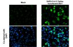 SARS-CoV-2 Spike Protein S2/S2' (strain Wuhan-Hu-1) Polyclonal Antibody