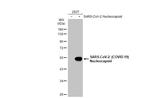 SARS-CoV-2 Nucleocapsid (strain Wuhan-Hu-1) Antibody in Western Blot (WB)