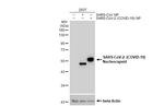 SARS-CoV-2 Nucleocapsid (strain Wuhan-Hu-1) Antibody in Western Blot (WB)
