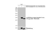Hepatitis D virus Polyclonal Antibody