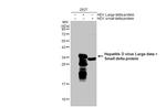 Hepatitis D virus Polyclonal Antibody