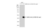 SARS-CoV-2 NSP3 (strain Wuhan-Hu-1) Antibody in Western Blot (WB)