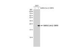 SARS-CoV-2 ORF8 (strain Wuhan-Hu-1) Antibody in Western Blot (WB)