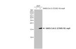 SARS-CoV-2 NSP9 Antibody in Western Blot (WB)