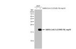 SARS-CoV-2 NSP10 Antibody in Western Blot (WB)
