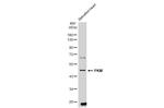 TGF beta-1 Polyclonal Antibody