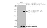 SARS-CoV-2 Spike (A222V Mutant) Polyclonal Antibody