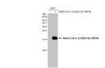 SARS-CoV-2 ORF9b Polyclonal Antibody