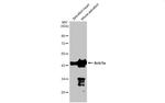 alpha-Cardiac Actin Antibody in Western Blot (WB)
