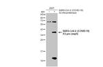 SARS-CoV-2 NSP5 Polyclonal Antibody