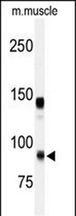 ADAMTS5 Polyclonal Antibody