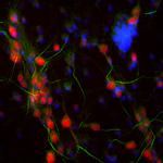 Ankyrin G Polyclonal Antibody