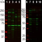 Ankyrin G Antibody in Western Blot (WB)