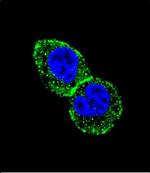 IDH1 Polyclonal Antibody