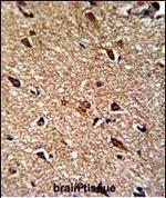 IDH1 Antibody in Immunohistochemistry (Paraffin) (IHC (P))