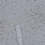 mCherry Antibody in Immunohistochemistry (Paraffin) (IHC (P))