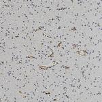 Nestin Antibody in Immunohistochemistry (Paraffin) (IHC (P))