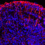 Nestin Antibody in Immunohistochemistry (Paraffin) (IHC (P))