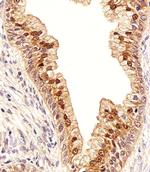 IDH1 Antibody in Immunohistochemistry (Paraffin) (IHC (P))