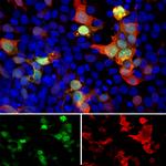 GFP Antibody in Immunocytochemistry (ICC/IF)