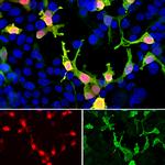 mCherry Antibody in Immunocytochemistry (ICC/IF)