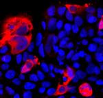 Cas12j Polyclonal Antibody