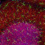 IBA1 Antibody in Immunohistochemistry (Paraffin) (IHC (P))