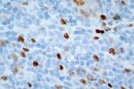 Ki-67 Antibody in Immunohistochemistry (Paraffin) (IHC (P))