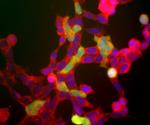 NSE Antibody in Immunocytochemistry (ICC/IF)