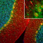 SCGN Polyclonal Antibody