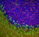 beta Synuclein Polyclonal Antibody