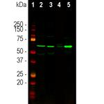 Tyrosine Hydroxylase Antibody in Western Blot (WB)