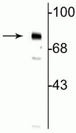 Phospho-MECP2 (Ser80) Polyclonal Antibody