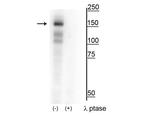 Phospho-MERTK (Tyr749, Tyr753, Tyr754) Polyclonal Antibody