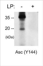 Phospho-PYCARD (Tyr144) Polyclonal Antibody