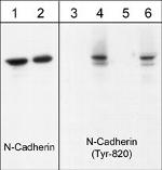 Phospho-N-cadherin (Tyr820) Antibody in Western Blot (WB)