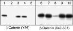 Phospho-beta Catenin (Tyr86) Antibody in Western Blot (WB)