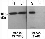 Phospho-EEF2K (Ser78) Polyclonal Antibody
