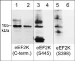 Phospho-EEF2K (Ser398) Polyclonal Antibody