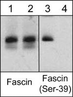 Phospho-Fascin (Ser39) Polyclonal Antibody