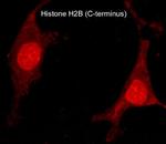Histone H2B Polyclonal Antibody