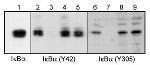 Phospho-IKB alpha (Tyr42) Polyclonal Antibody