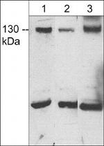 JMY Polyclonal Antibody
