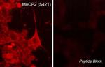 Phospho-MECP2 (Ser421) Polyclonal Antibody